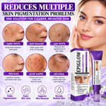 Nuvilo Advanced Anti-Hyperpigmentation Cream