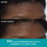 Peptide-Infused Face Tape