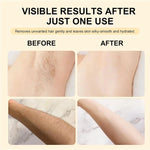 Umex Sensitive Skin Hair Removal Cream