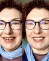 InstaSmile Pro