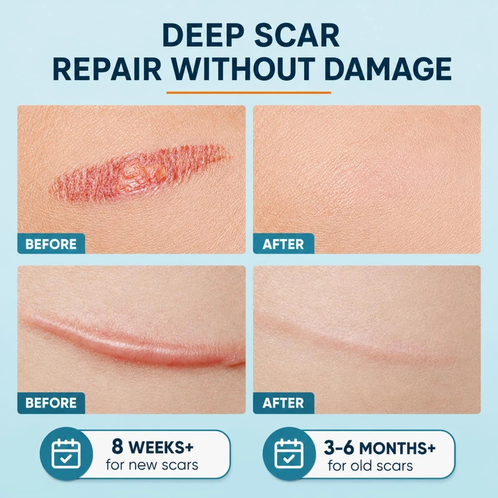 Eizoou Silicone Scar Gel