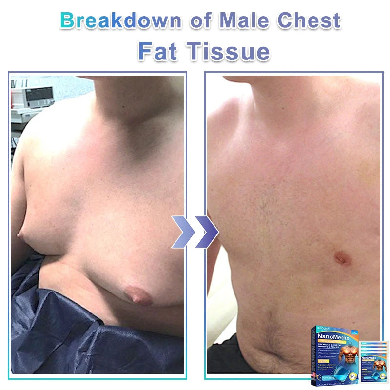 NanoMedix Chest Firming Fatburn Patch