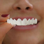 Natural Look Dental Veneers