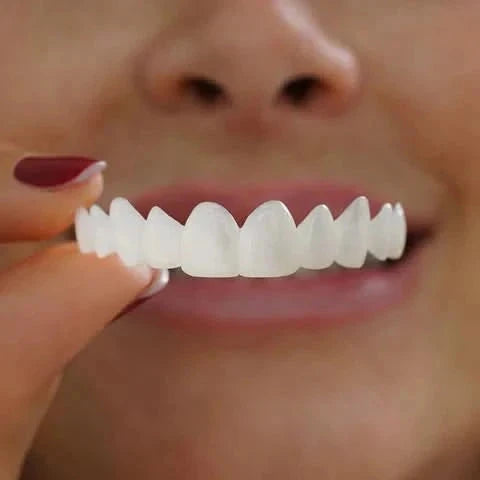 Natural Look Dental Veneers