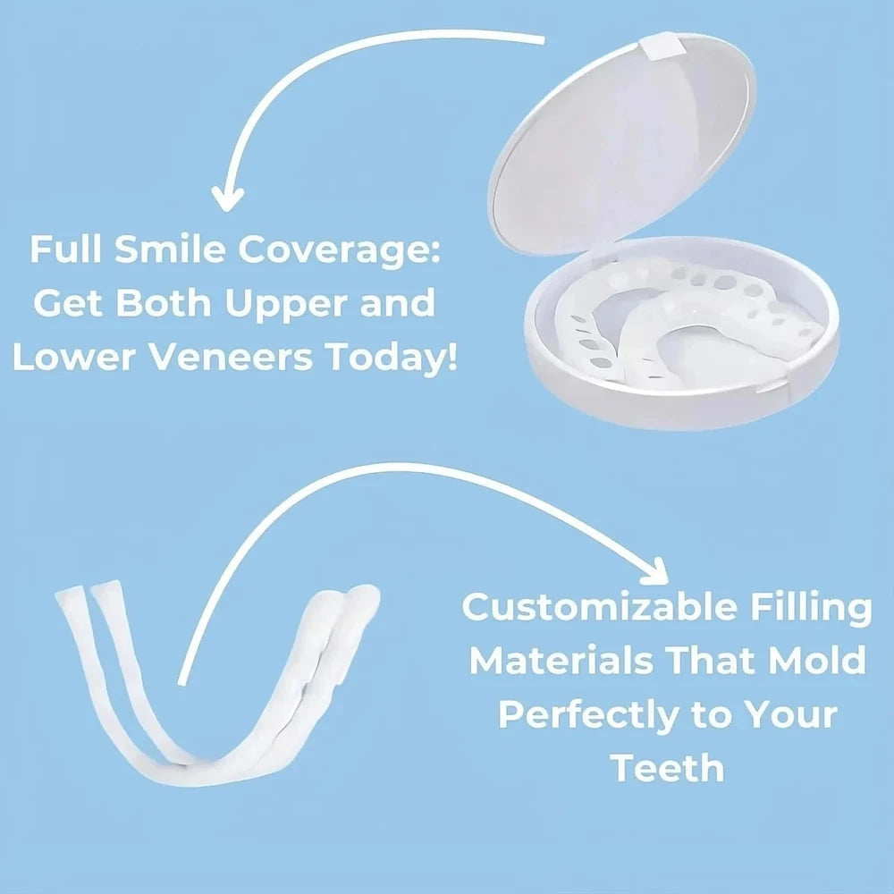 Natural Look Dental Veneers