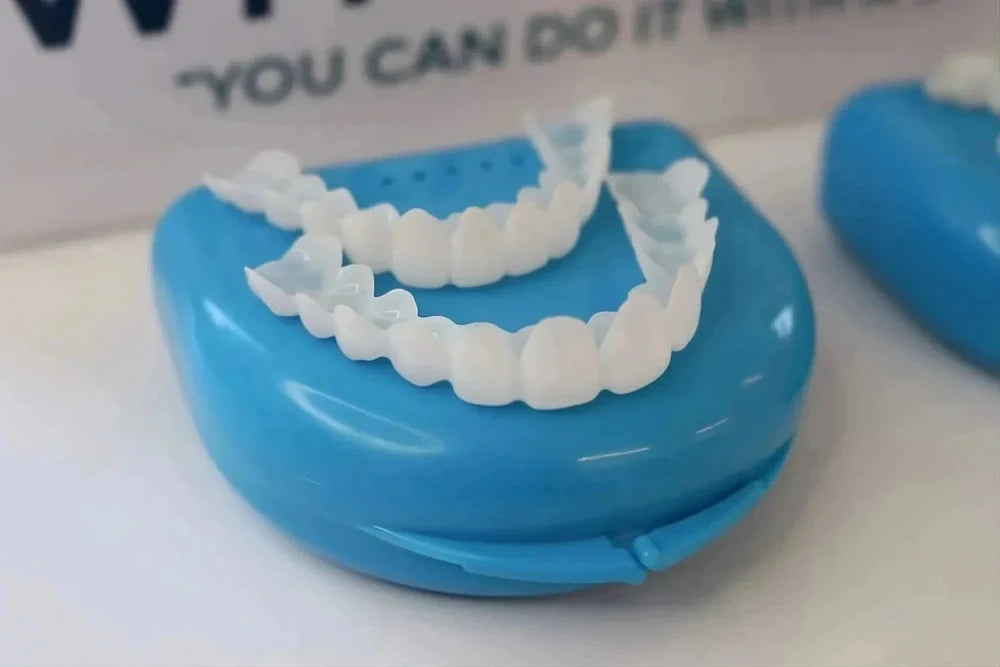 Natural Look Dental Veneers