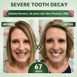 Tooth Repair Patch
