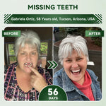 Tooth Repair Patch