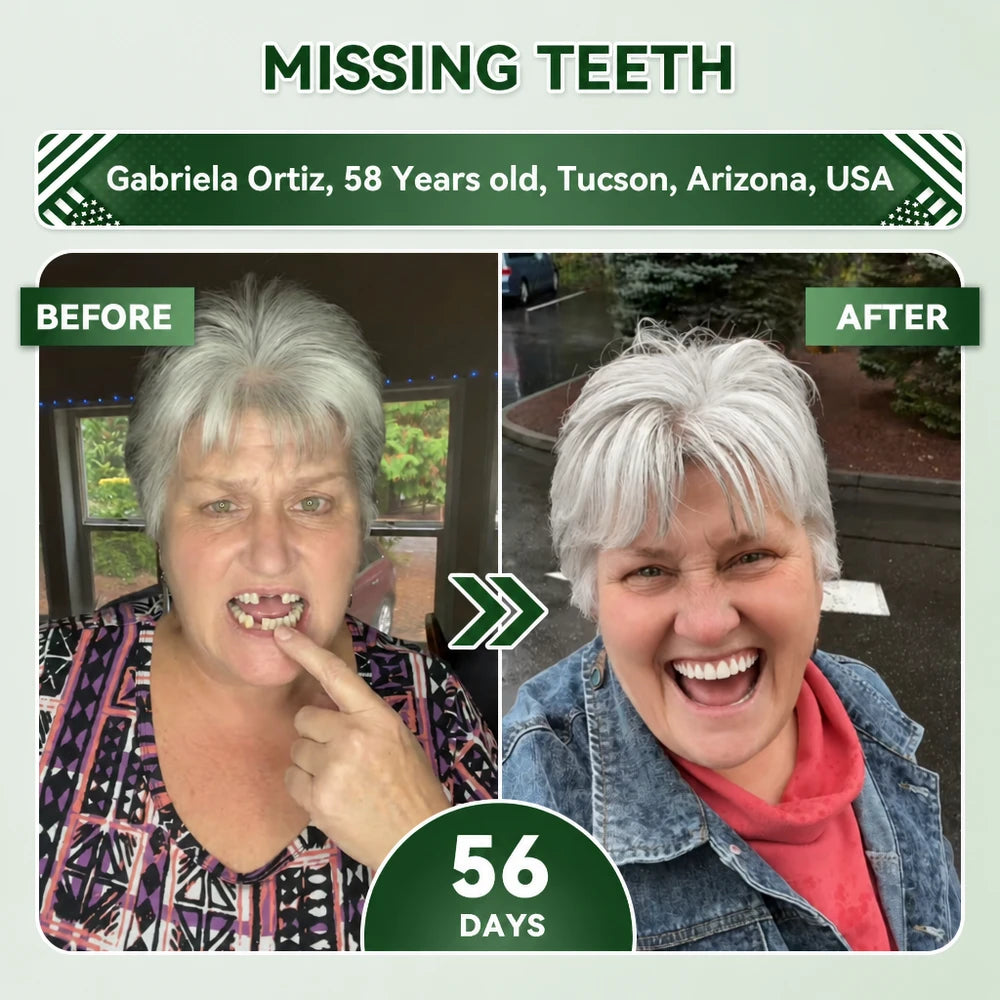 Tooth Repair Patch
