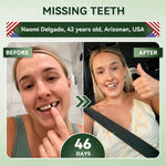 Tooth Repair Patch