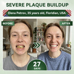 Tooth Repair Patch