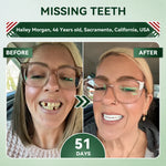 Tooth Repair Patch
