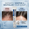 ScalpRenew Scalp Serum – Daily Hair &amp; Scalp Care