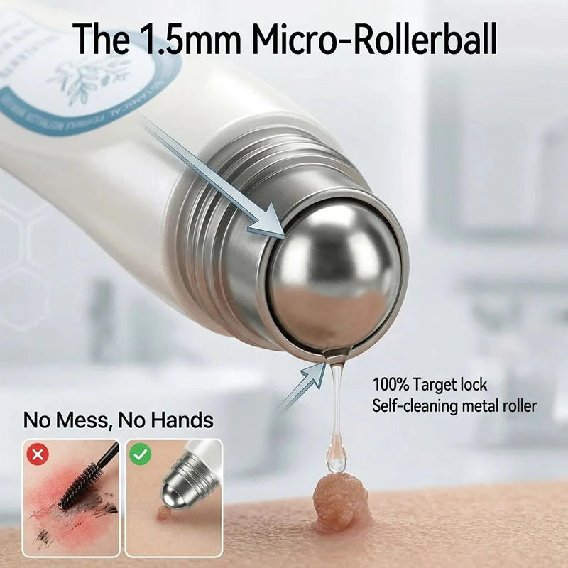 Wart Removal Rollerball Serum