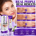 Nuvilo Advanced Anti-Hyperpigmentation Cream