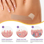 ScarLuxe Advanced Nano Microneedle Scar Care Tape